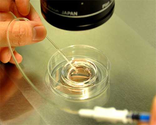 试管婴儿胚胎级别表8