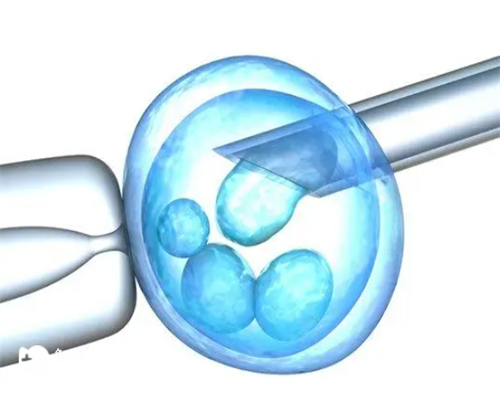 广州三代试管有没有不用排队的医院？要等多久