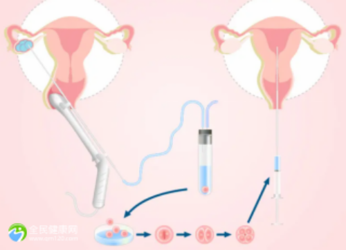 居然可以这样|中国最好的助孕都有哪家?_北京助孕联系方式