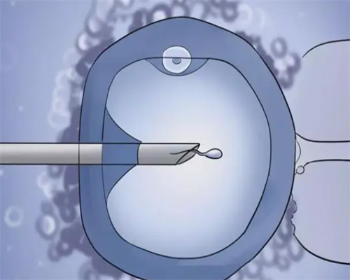 广州借腹代孕医院,广州艾琳供卵,广州供卵价格