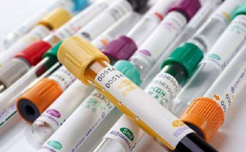 广州代怀包性别,广州玻璃试管厂，广州恒龙玻璃钢化厂