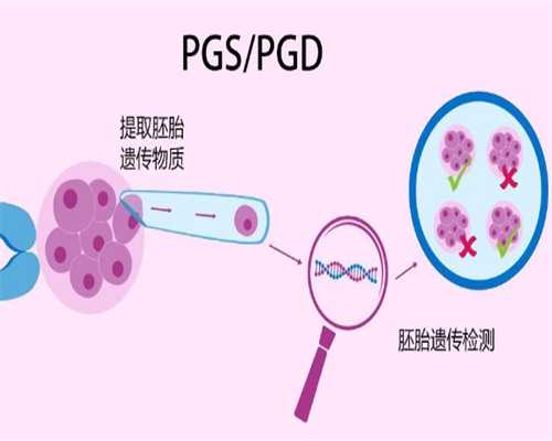 广州帮人代怀产子价格 广州试管婴儿的价格 ‘肚型真能看男女吗’
