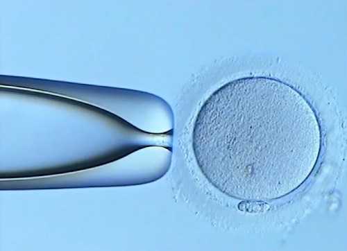 怎么用肉眼判断自己精液中是否有精子