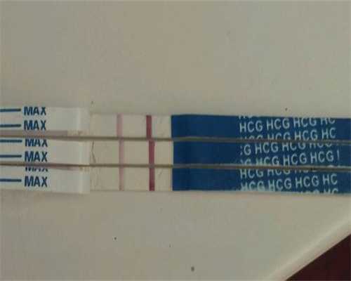 广州代生宝宝价钱,卵子质量差试管婴儿胚胎移植多次失败能有其它的办法好孕