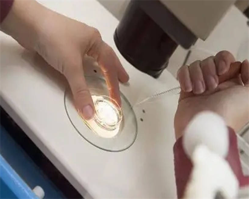 试管女的要做什么检查