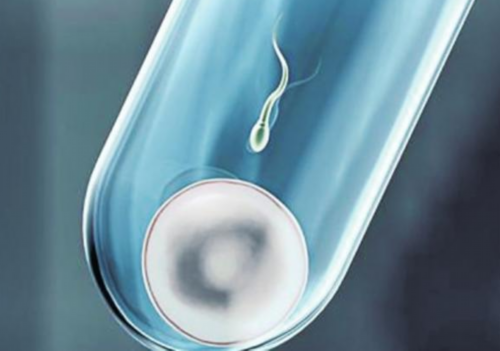 广州哪里有代孕医院,广州卵巢早衰试管婴儿,广州看卵巢早衰好的医生