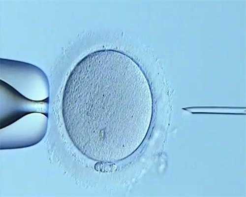 医疗保险做试管婴儿可以报销吗