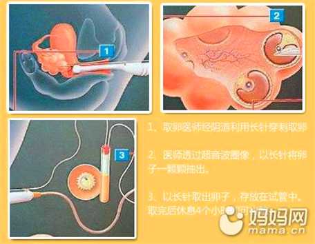 广州代孕哪家专业,女人43岁还能生二胎吗 高龄怀
