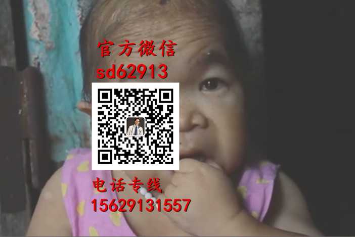 广州代孕女电话-胎盘2到3级能维持多久