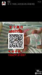 广州试管婴儿医院排名：11周胎儿nt值正常范围是