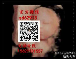 广州代孕包性别_孕妇食疗补血的六大误区