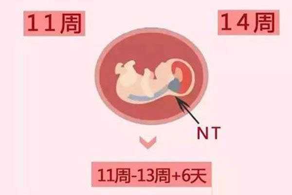 <b>广州生殖助孕哪个医院好_nt检查最佳检查时间在孕几周？nt检查最佳时间怎么计</b>