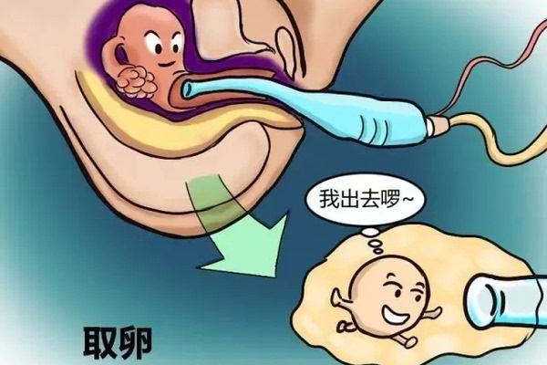 为延续香火找代孕-广州代孕网站哪家靠谱_人工授精让不孕不育家庭摆脱备孕困