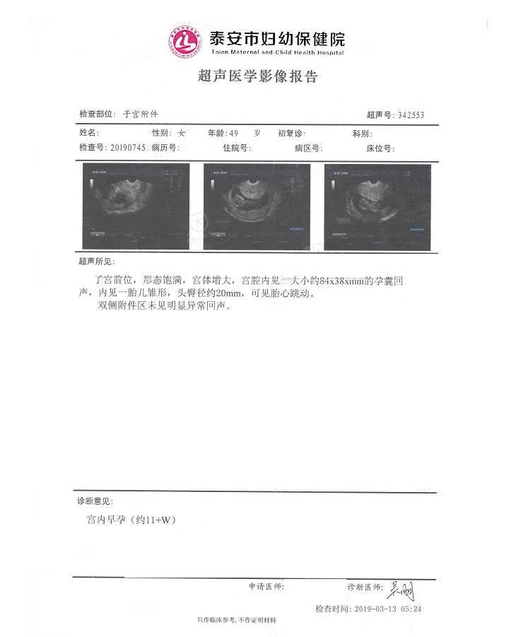 广州代孕孩子有别人细胞吗-代孕什么地方便宜_南充姐妹分享有图有真相！49岁