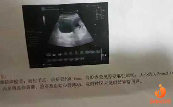 广州合法代孕一般多少钱-代孕生子联系方式_【上海红房子有没供卵的医院多吗